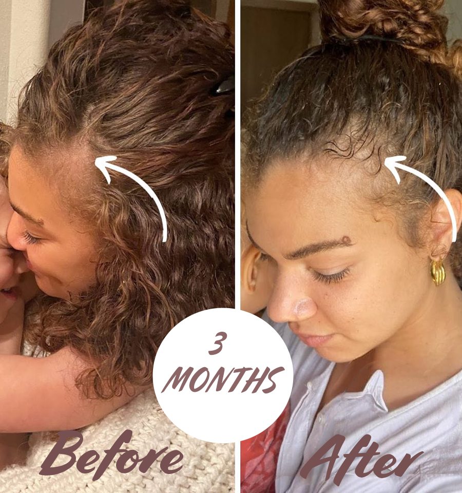 Revitalize Your Hair, Transform Your Confidence!